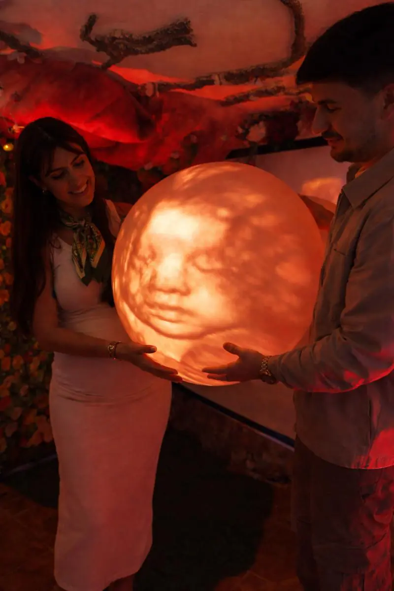 ecografia-elenathomsen-proyeccion-luna